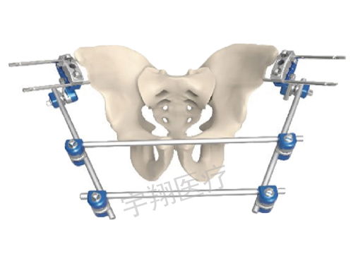骨盆固定